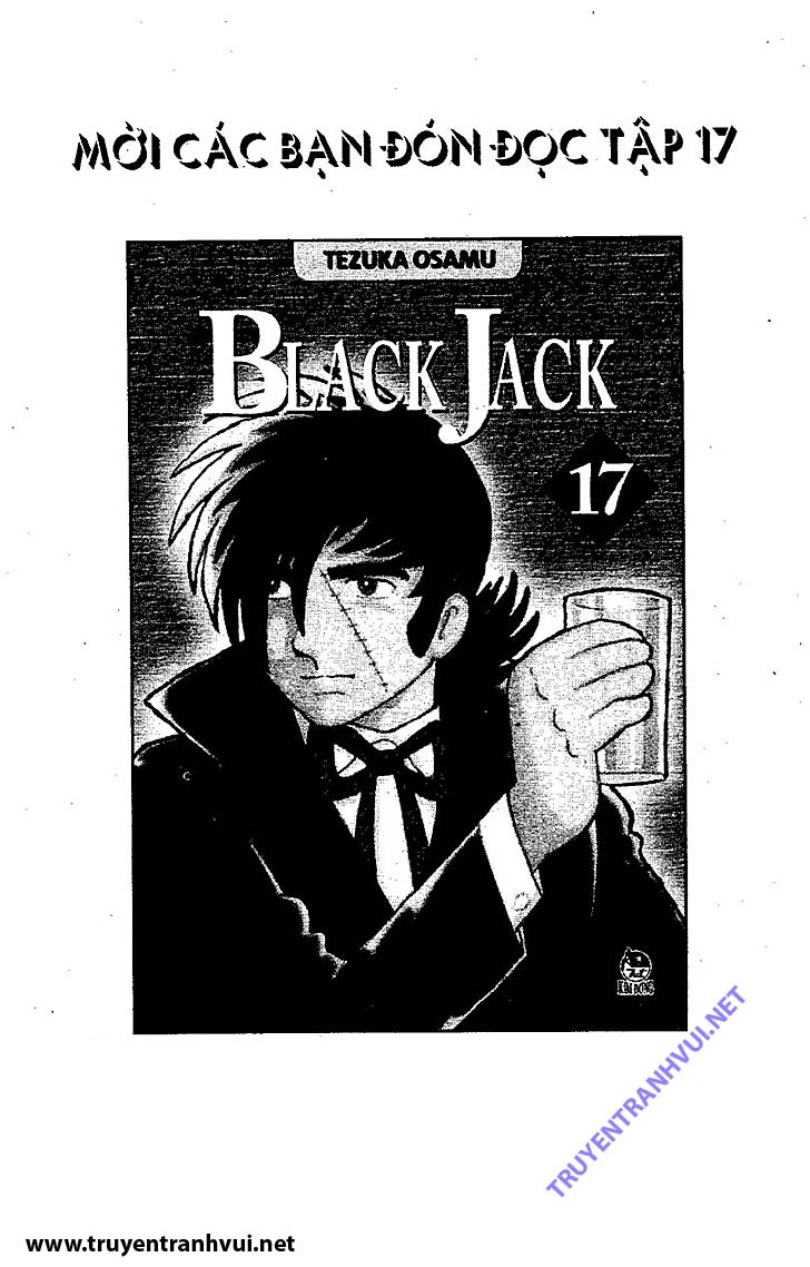 Black Jack (Bác Sĩ Quái Dị) chap 160: Ngón tay ngắn  